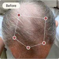 Before Treatment