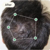 After Treatment
