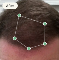 After Treatment