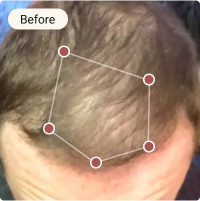 Before Treatment