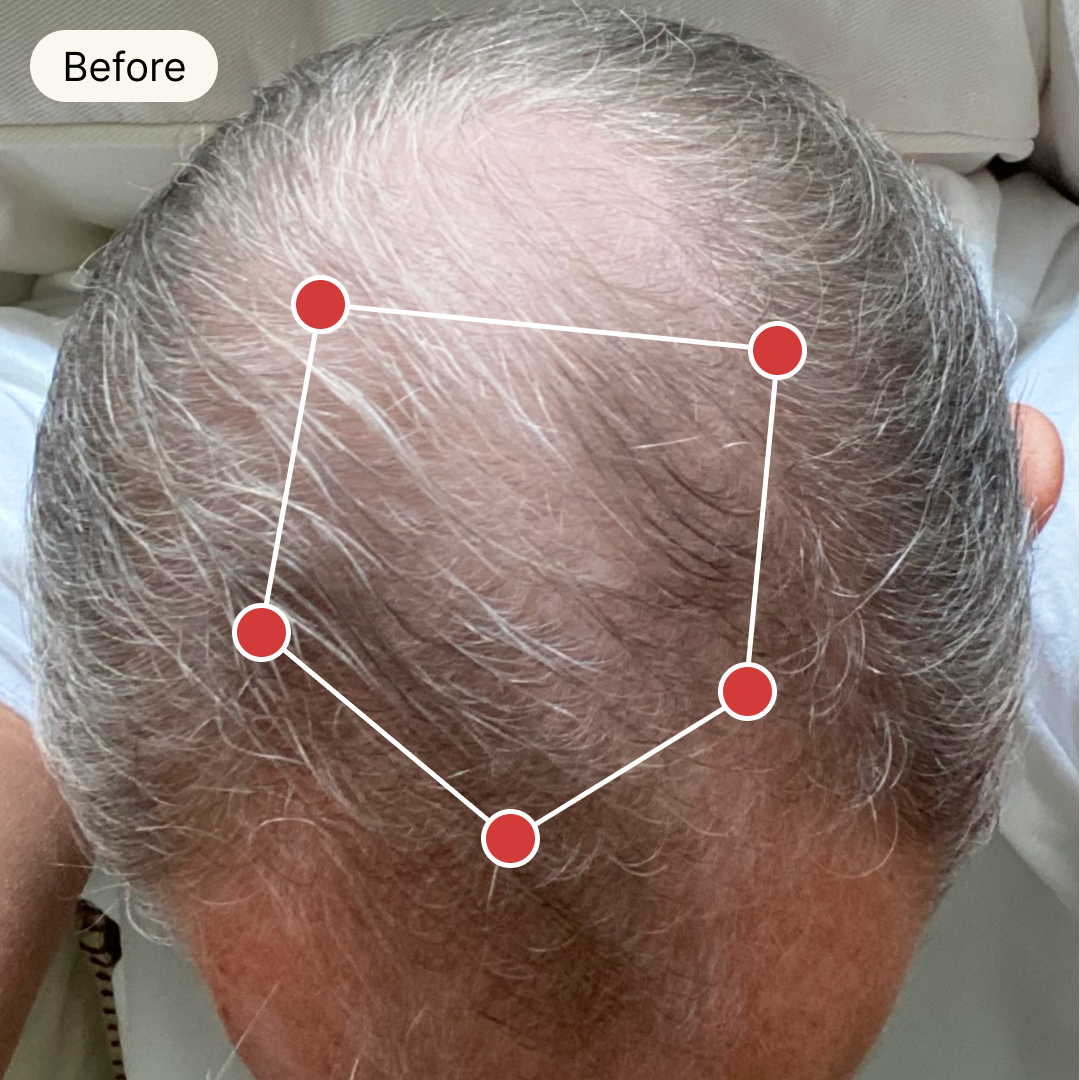 Before Treatment