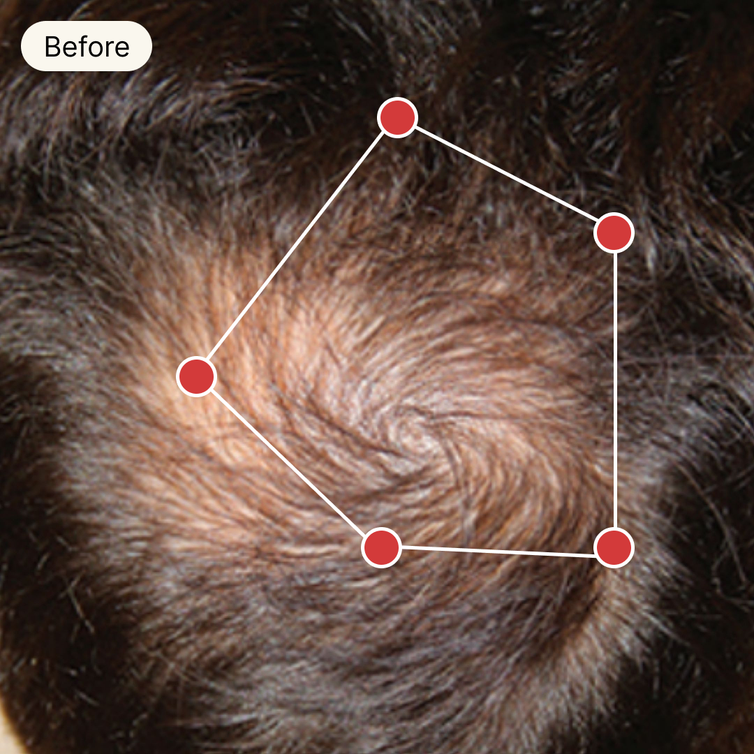 Before Treatment