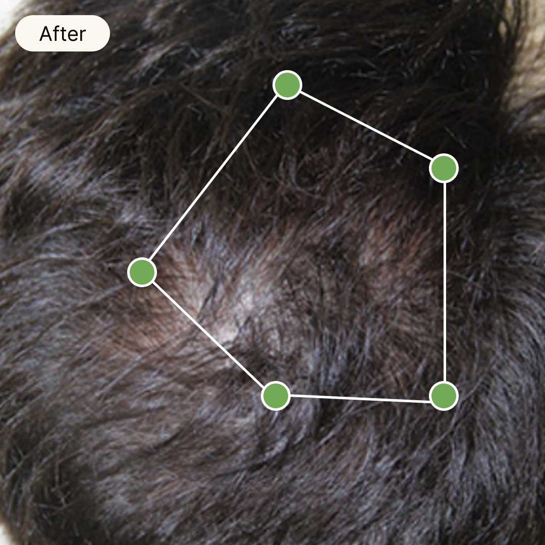 After Treatment